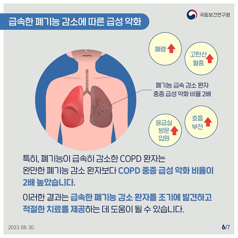 국립보건연구원 / 급속한 폐기능 감소에 따른 급성 악화 / 폐렴(증가), 고탄산 혈증(증가) 폐기능 급속 감소 환자 중증 급성 악화 비율 2배, 호흡 부전(증가), 응급실 방문 입원(증가) 특히, 폐기능이 급속히 감소한 COPD 환자는 완만한 폐기능 감소 환자보다 COPD 중증 급성 악화 비율이 2배 높았습니다. 이러한 결과는 급속한 폐기능 감소 환자를 조기에 발견하고 적절한 치료를 제공하는 데 도움이 될 수 있습니다. 2023.08.30. 6/7