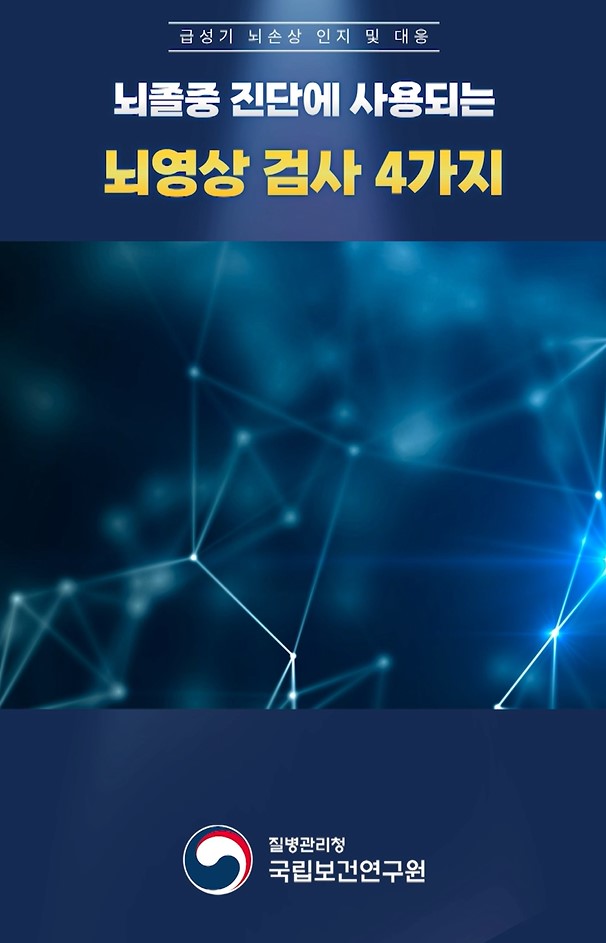 뇌졸중 진단에 사용되는 뇌영상 검사 4가지