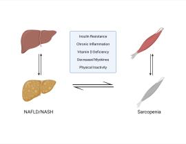 How Your Muscle Mass Affects Your Liver Health: Exploring the Link Between Sarcopenia and NAFLD