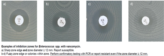 Enterococcus spp.에 대한 억제 구역의 예