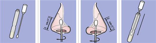 사람 비강 검체 채취 예시