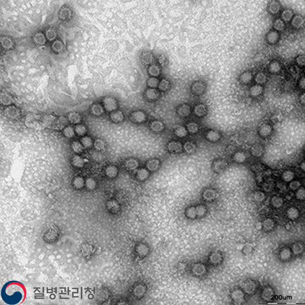 Chikungunya virus 이미지