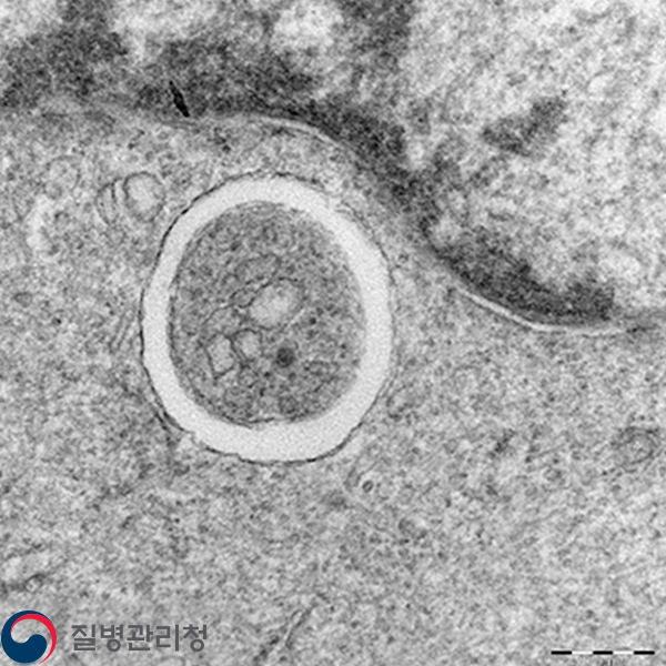 Dengue virus 이미지