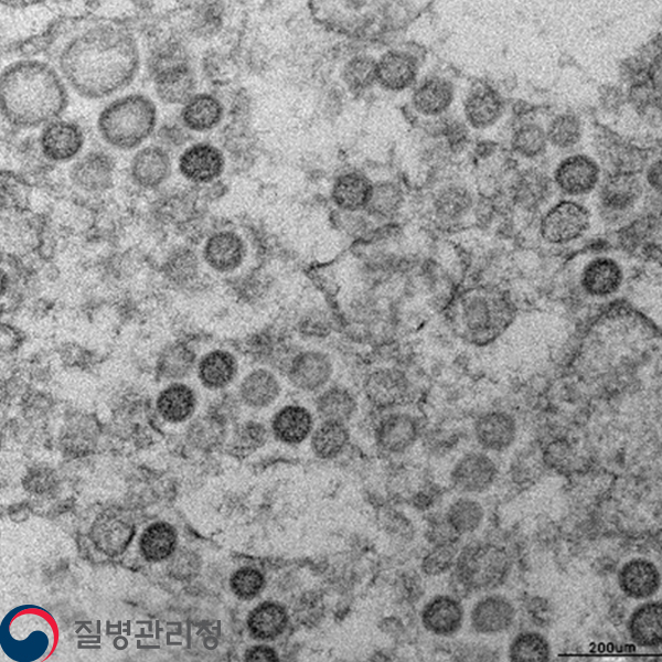 MERS corona virus 이미지