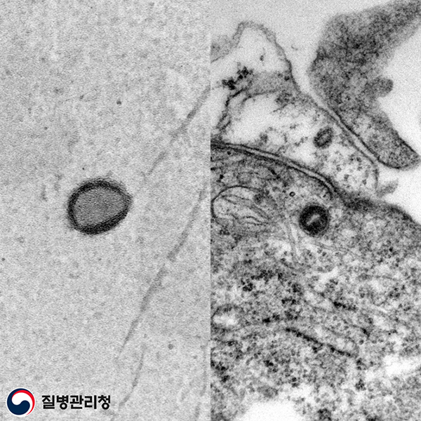 Monkeypox virus(엠폭스) 이미지