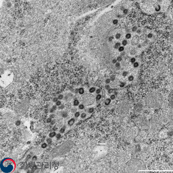 Rabies virus 이미지