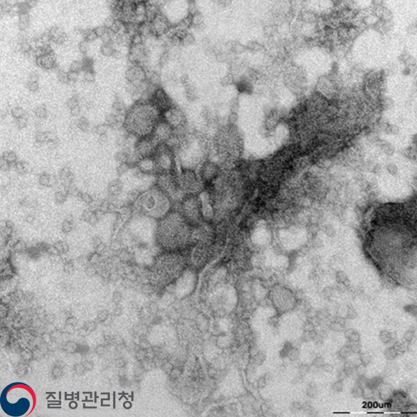 Respiratory syncytial virus 이미지