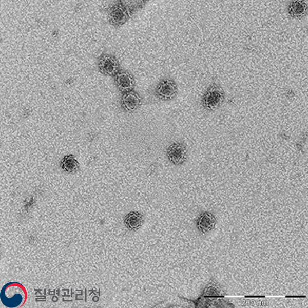 Rota virus 이미지