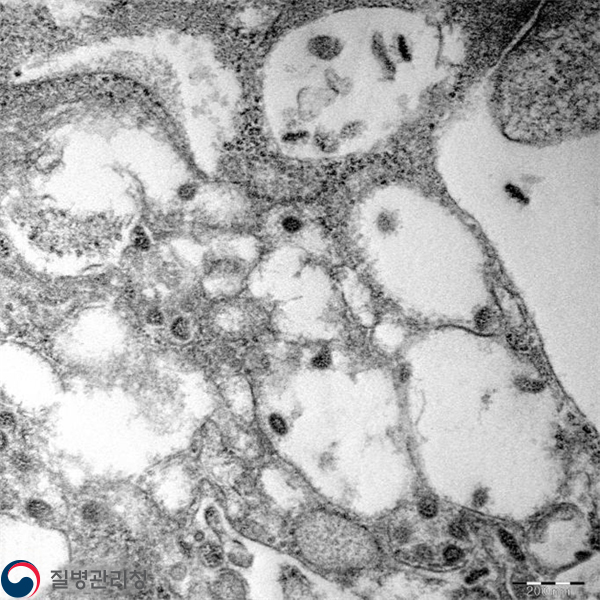 SARS-CoV-2 이미지