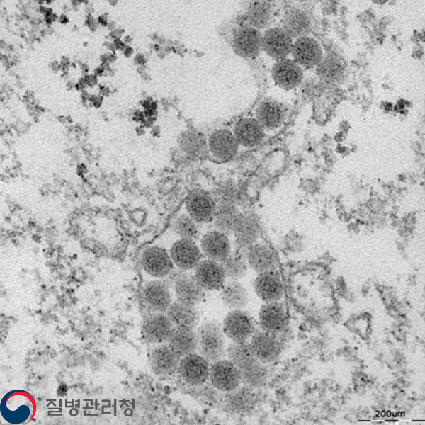 SFTS virus 이미지