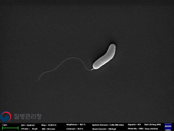 Vibrio cholerae O1 이미지